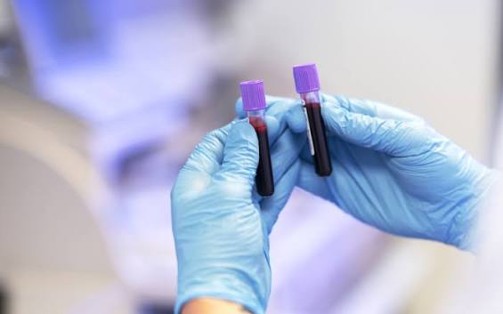 Small Test Big Protection The Importance of Regular Blood Tests for a Healthier Tomorrow